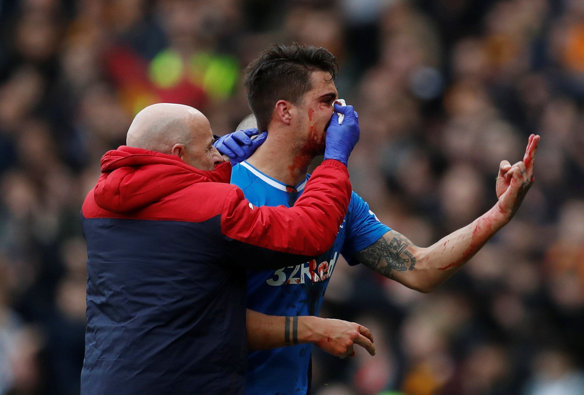 Soccer Football - Scottish League Cup Semi Final - Rangers vs Motherwell - Hampden Park, Glasgow, Britain - October 22, 2017   Rangers’ Fabio Cardosa leaves the pitch to receive medical attention    REUTERS/Russell Cheyne