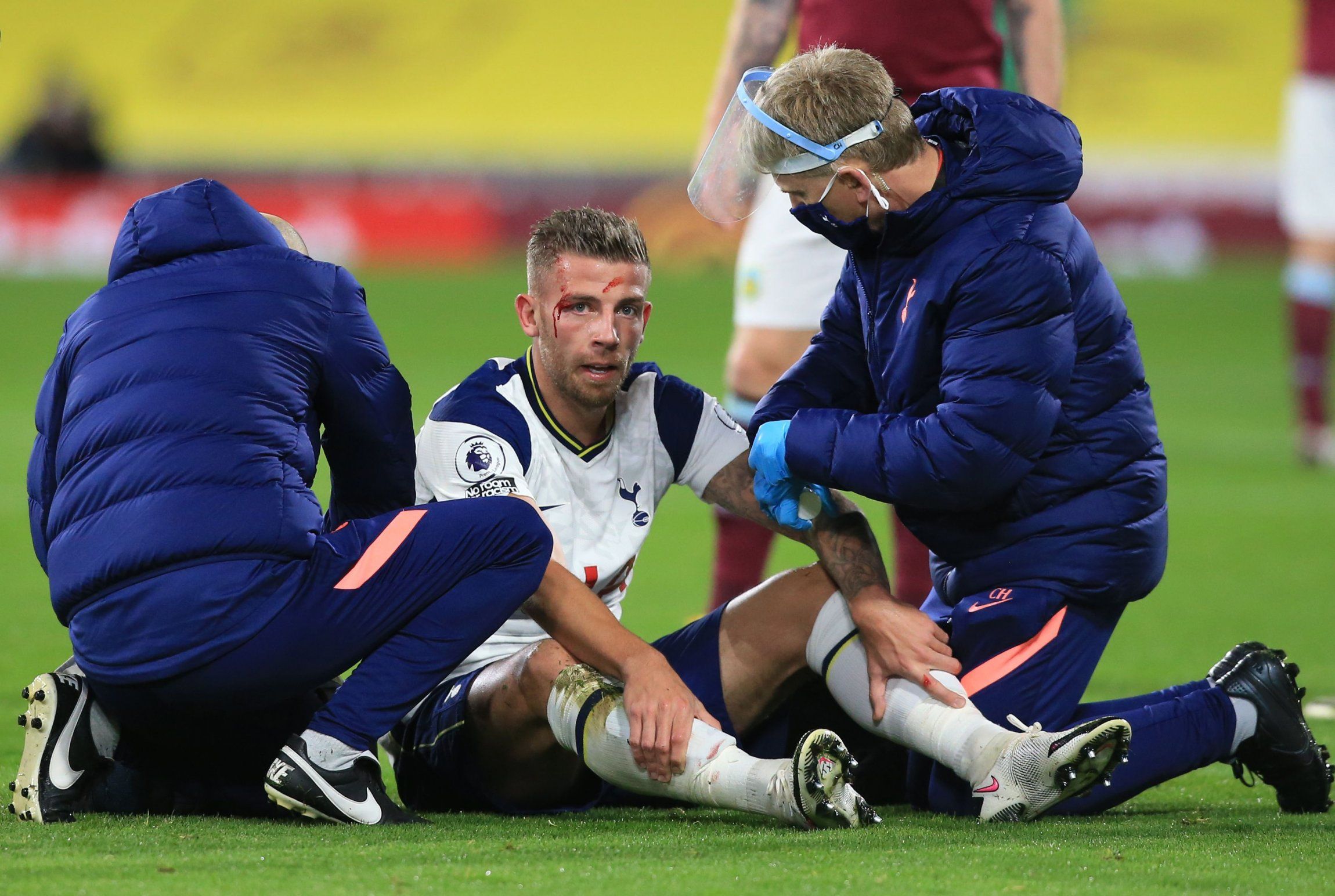 spurs-defender-toby-alderweireld-injured
