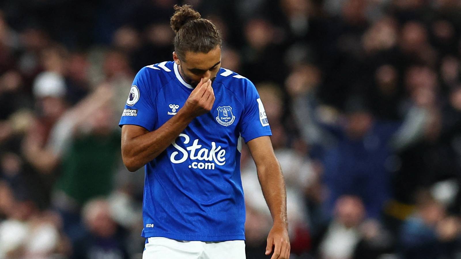 Everton: Dyche drops DCL injury update