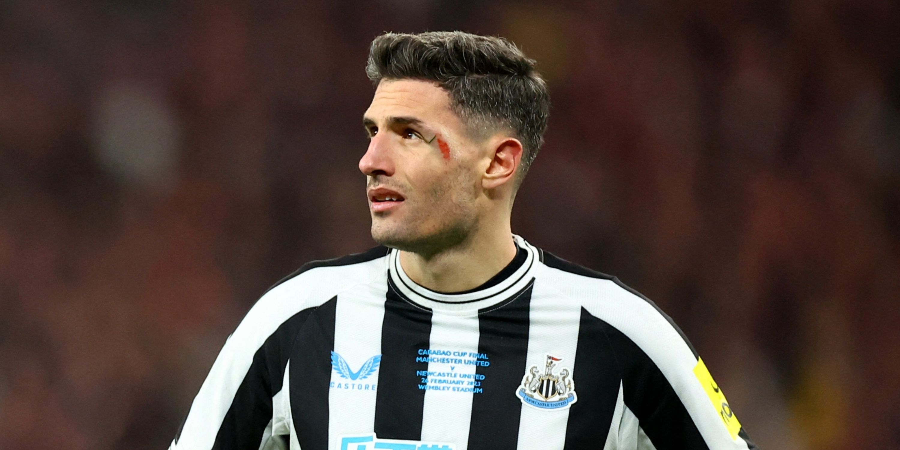 Hành Trình và Kinh Nghiệm Tuyến Phòng Ngự của Fabian Schär Hành Trình và Kinh Nghiệm Tuyến Phòng Ngự của Fabian Schär