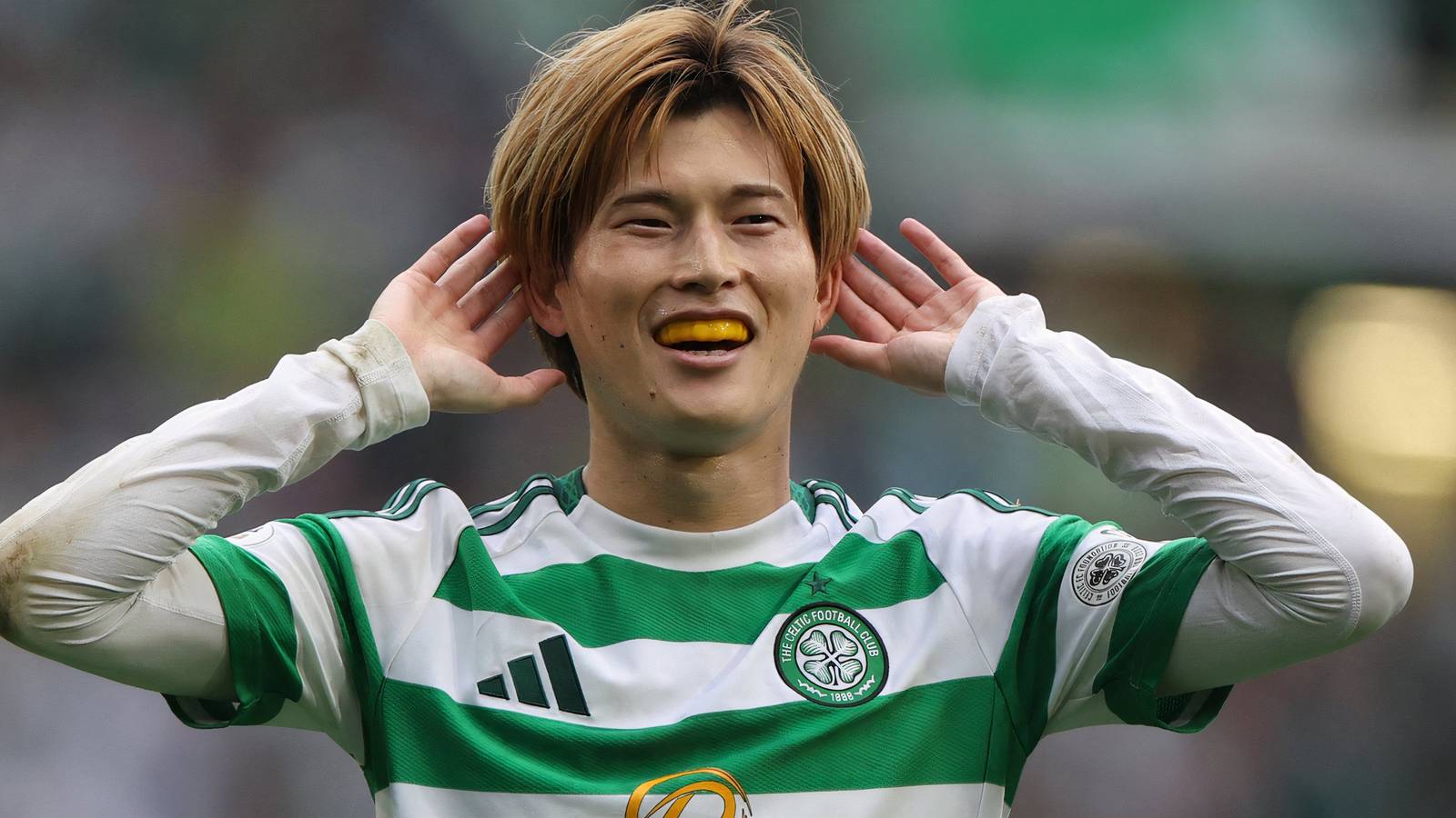 Nancy could sign his own Kyogo with CF interested in Celtic transfer