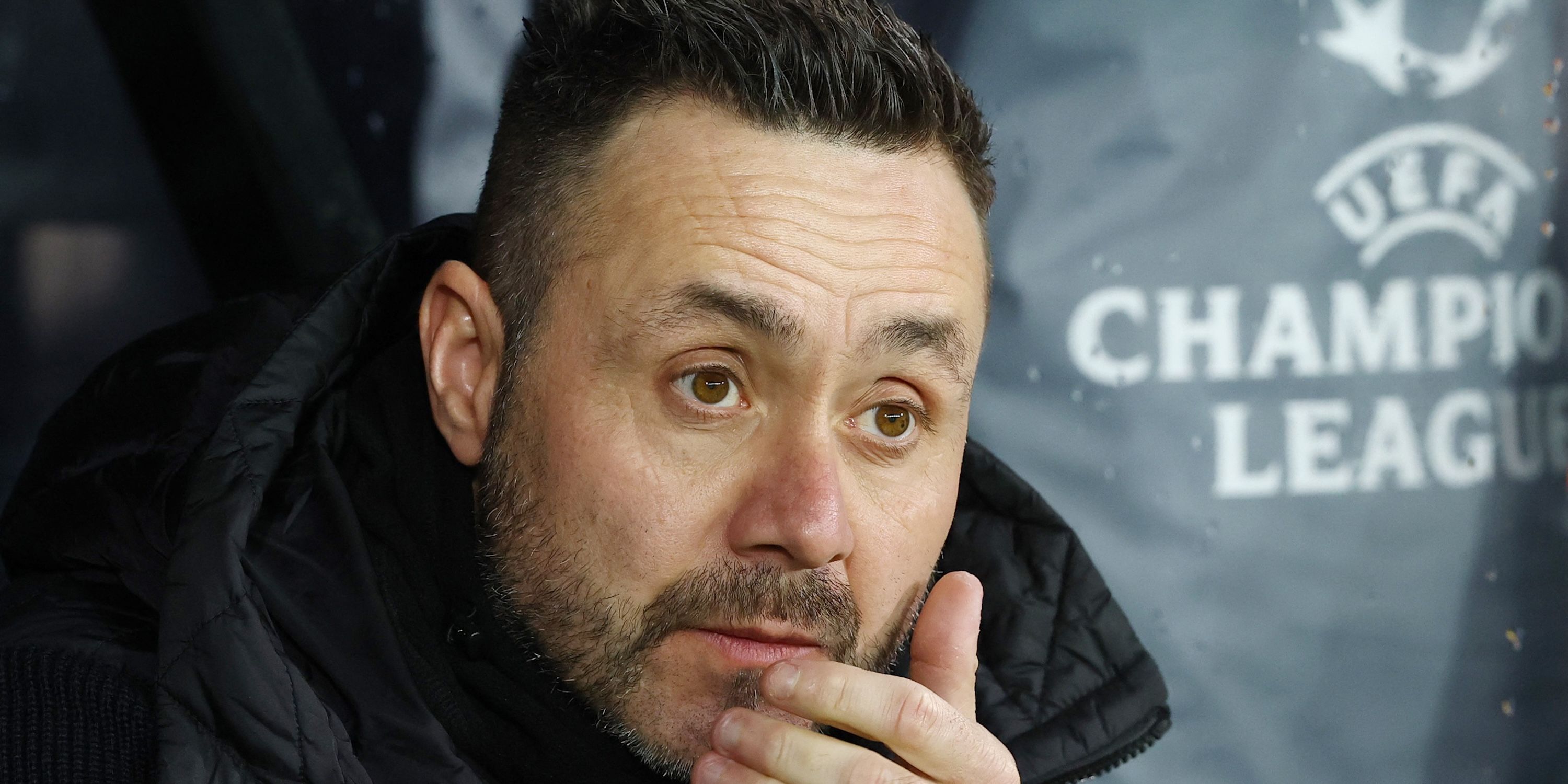 Roberto De Zerbi before the match